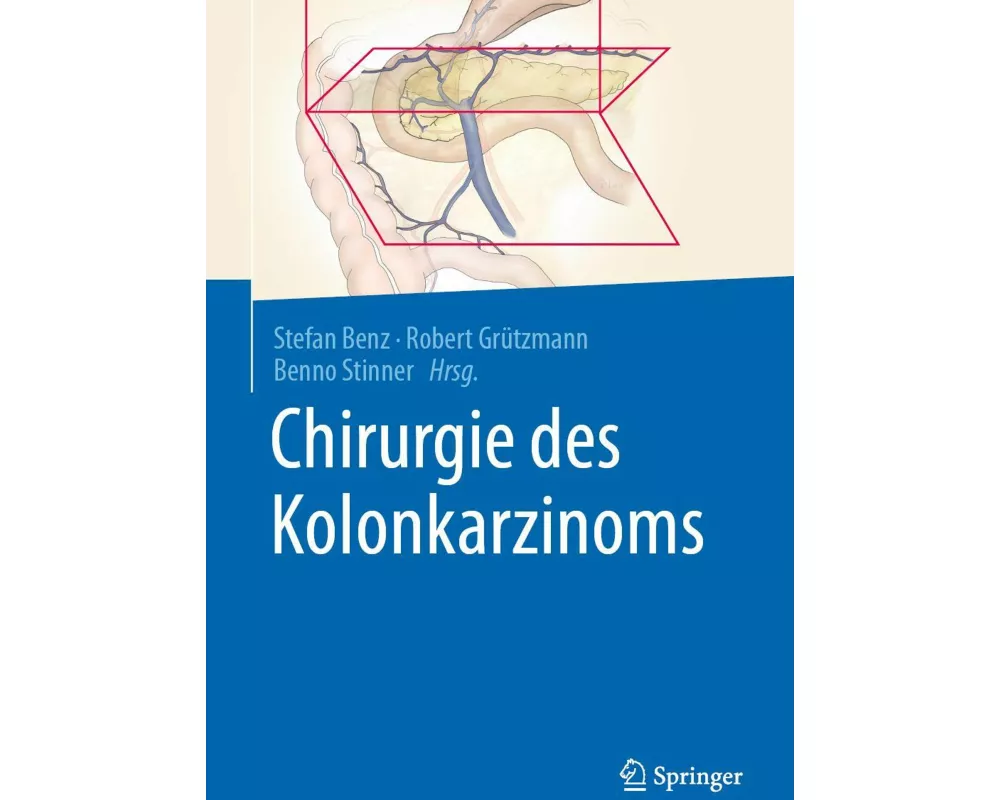 Chirurgie des Kolonkarzinoms
