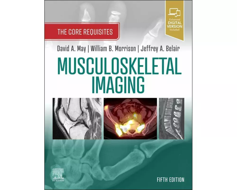 Musculoskeletal Imaging
