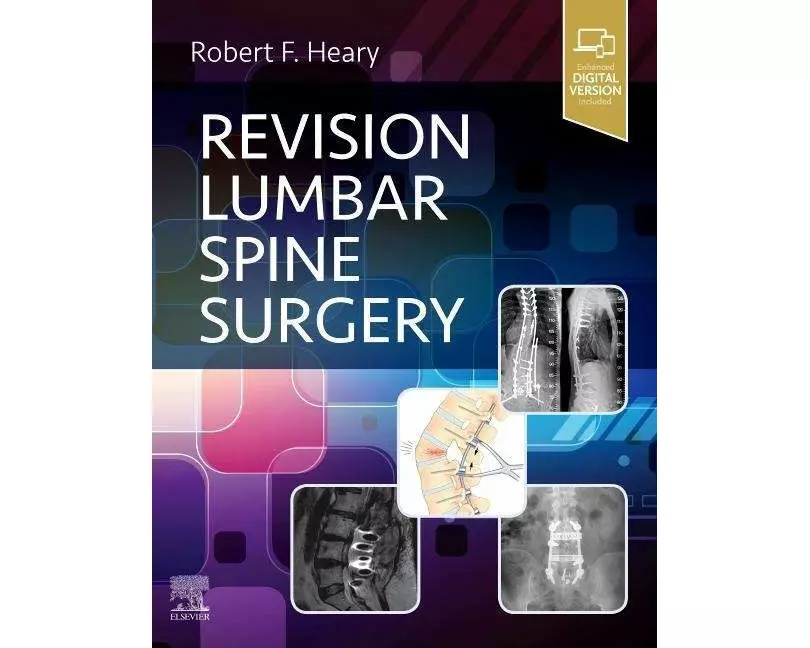 Revision Lumbar Spine Surgery