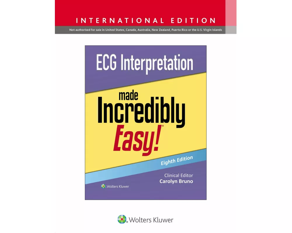 ECG Interpretation Made Incredibly Easy!