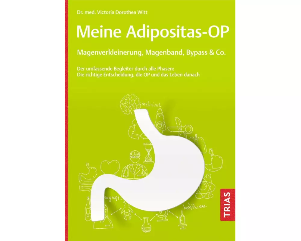 Meine Adipositas-OP. Magenverkleinerung, Magenband, Bypass & Co