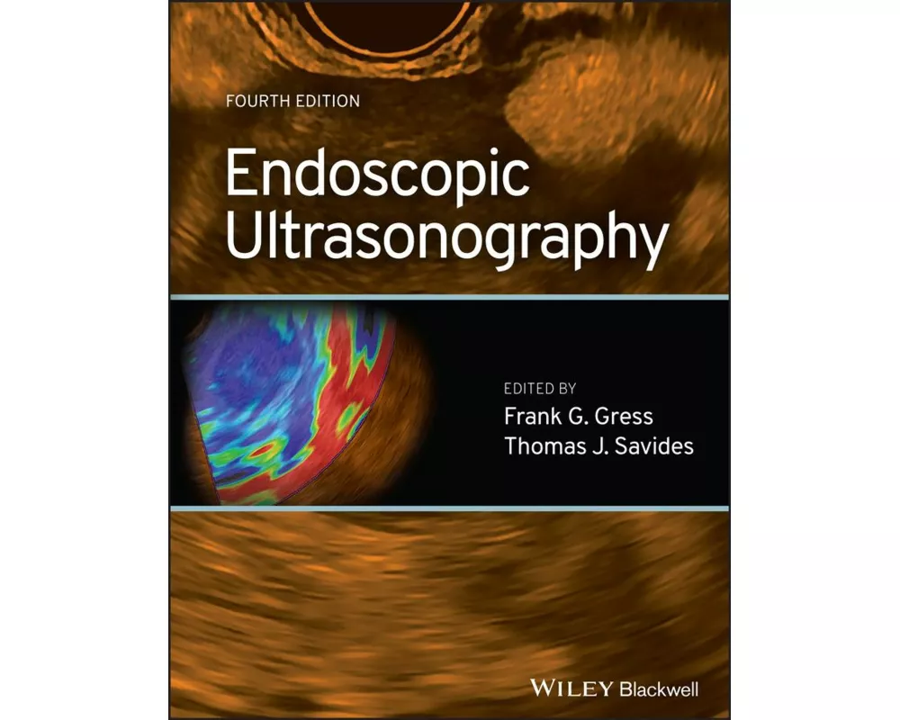 Endoscopic Ultrasonography