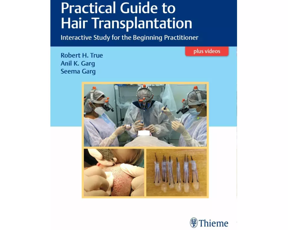 Practical Guide to Hair Transplantation