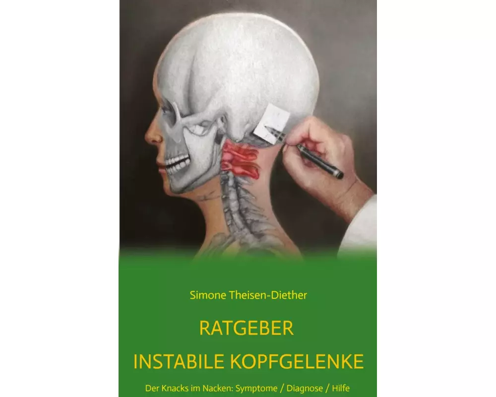 Ratgeber Instabile Kopfgelenke
