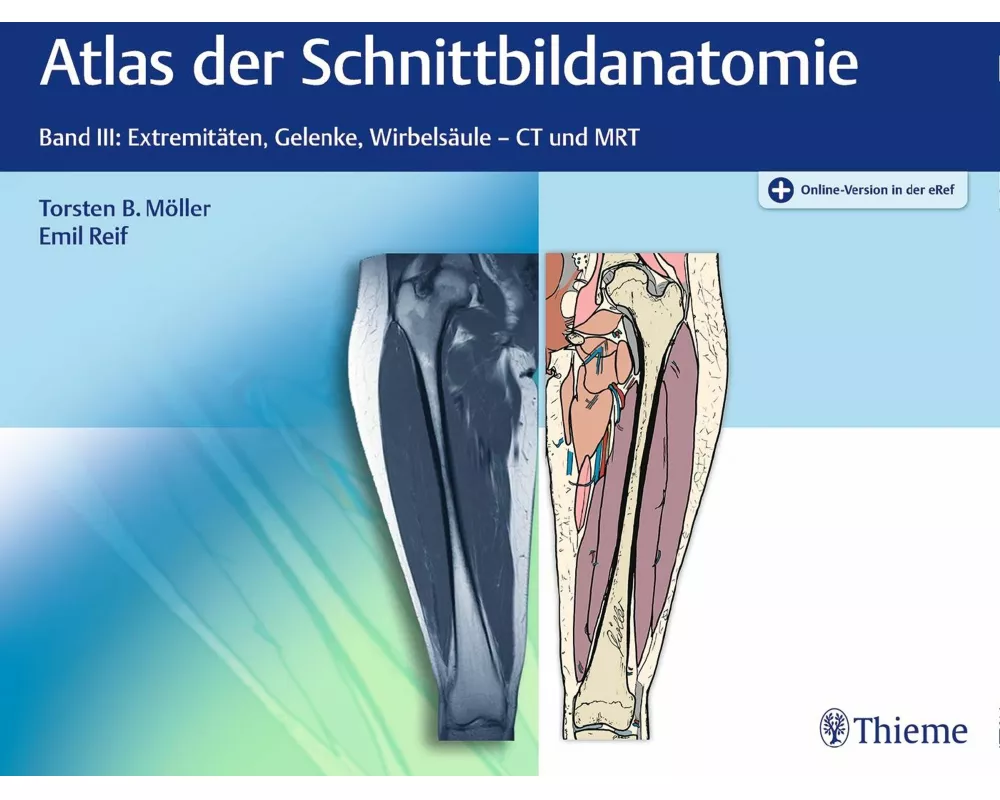 Atlas der Schnittbildanatomie. Band 03