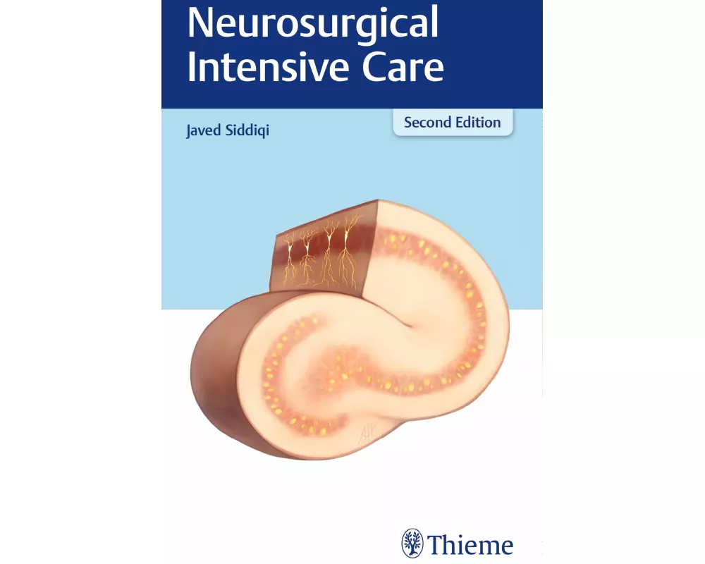 Neurosurgical Intensive Care