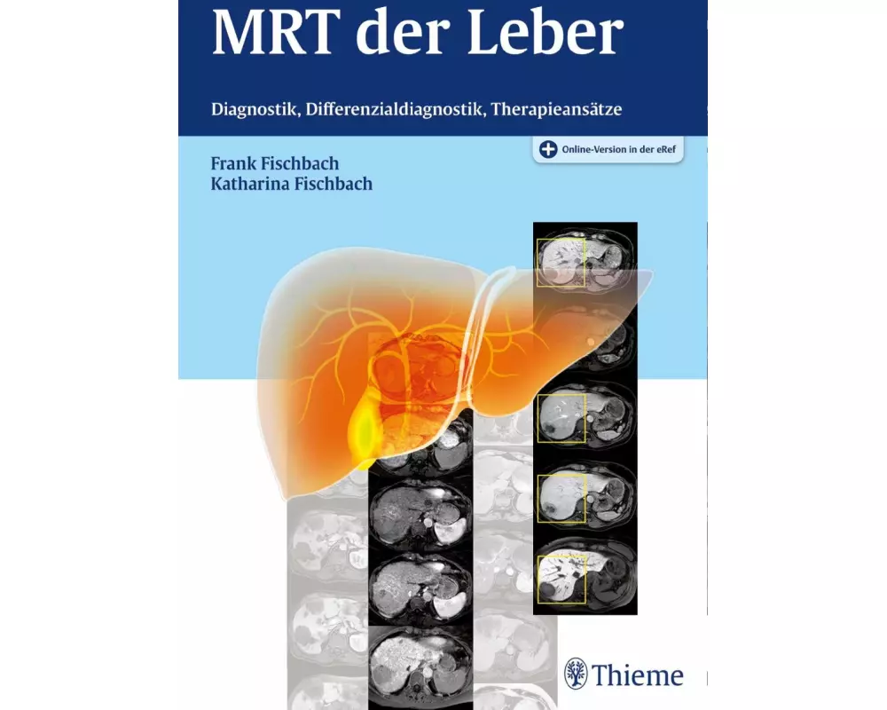 MRT der Leber
