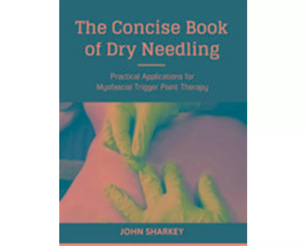 The Concise Book of Dry Needling