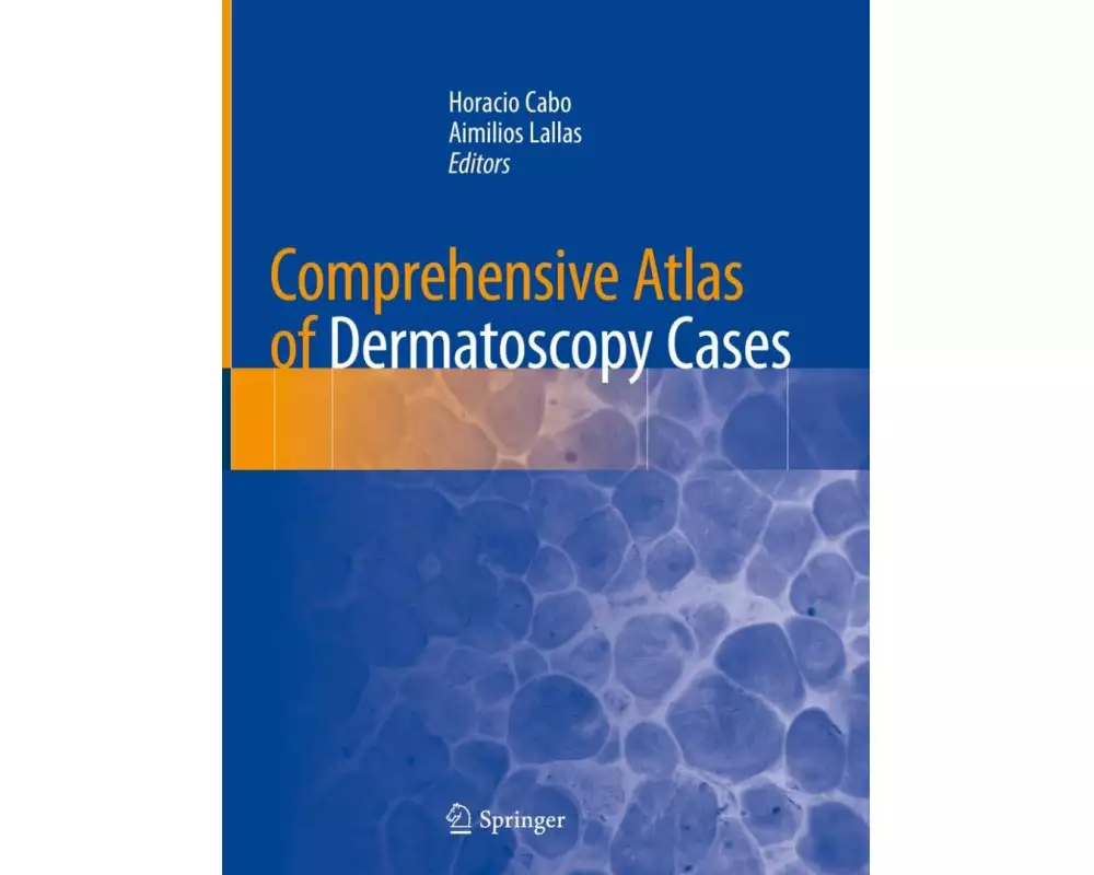 Comprehensive Atlas of Dermatoscopy Cases