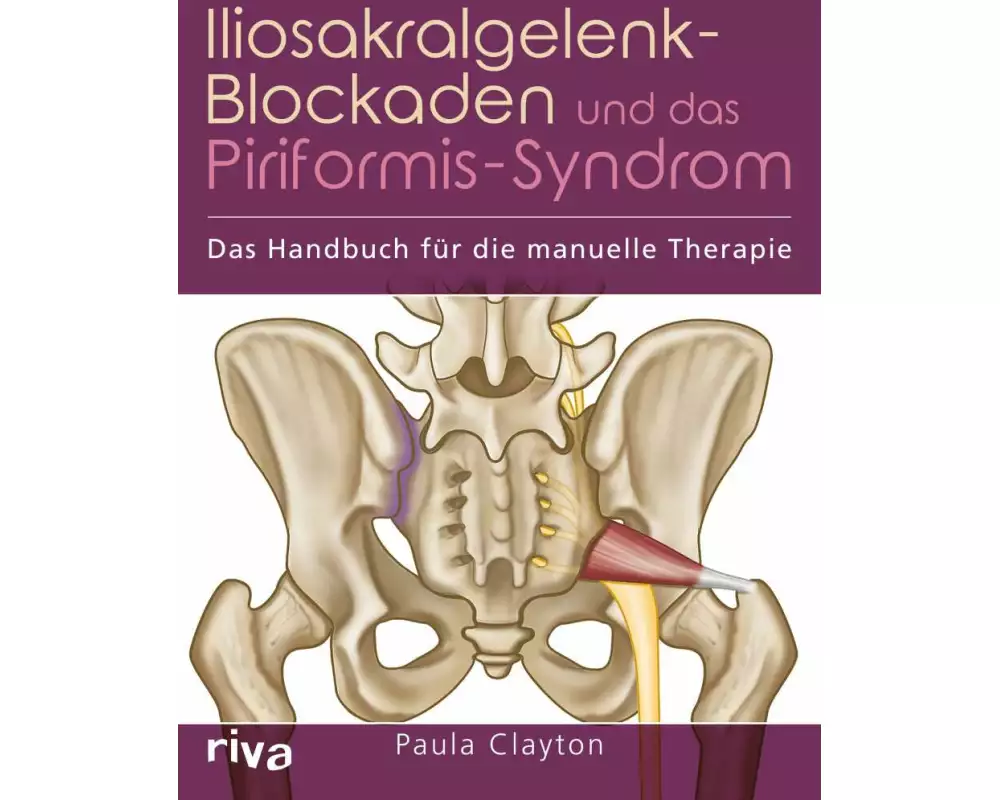 Iliosakralgelenk-Blockaden und das Piriformis-Syndrom