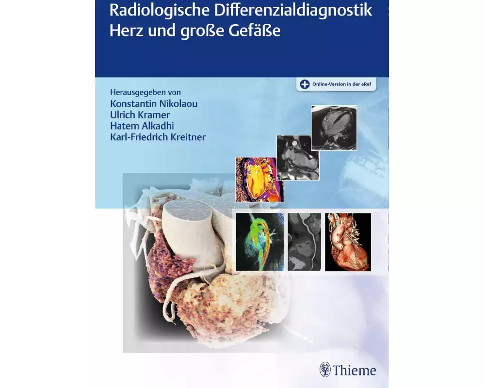 Radiologische Differenzialdiagnostik Herz und große Gefäße