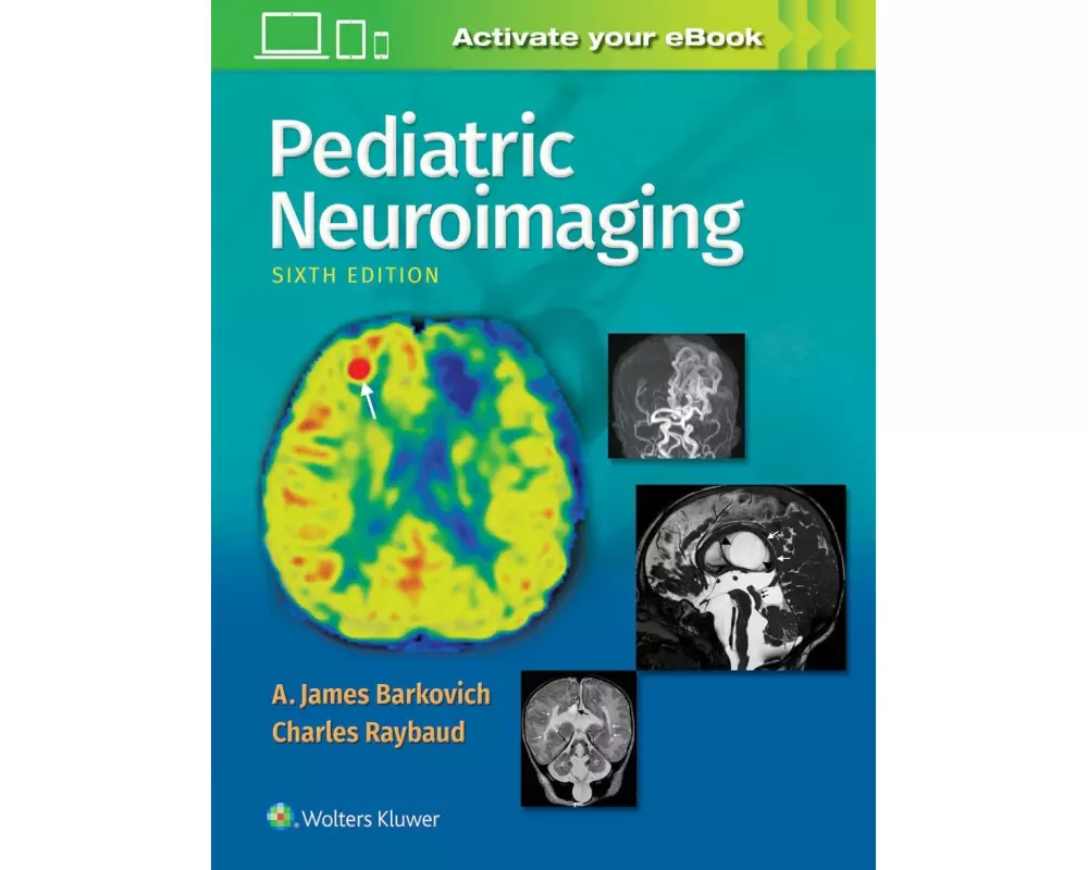 Pediatric Neuroimaging