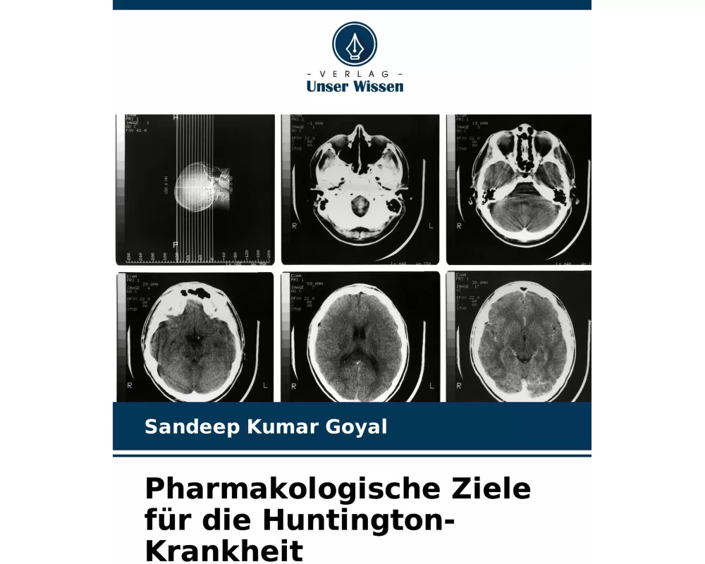 Pharmakologische Ziele für die Huntington-Krankheit