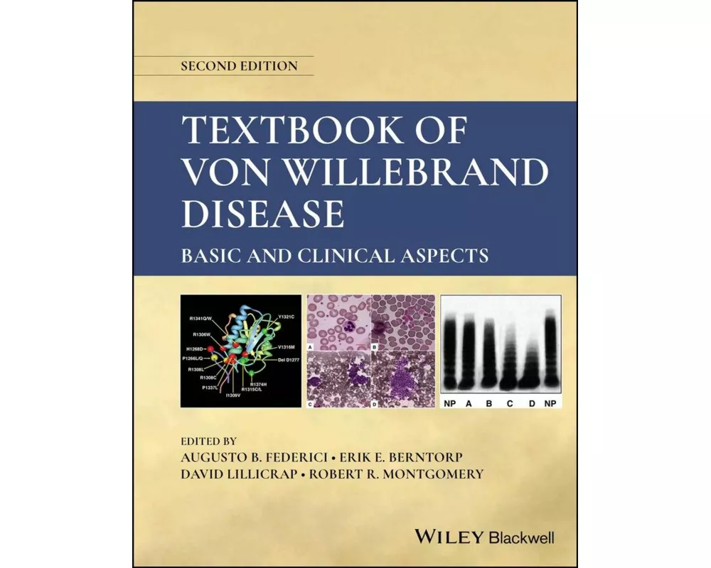 Textbook of Von Willebrand Disease