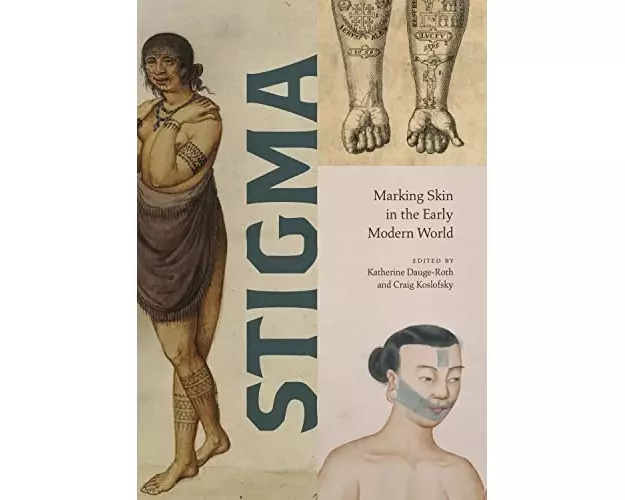 Stigma