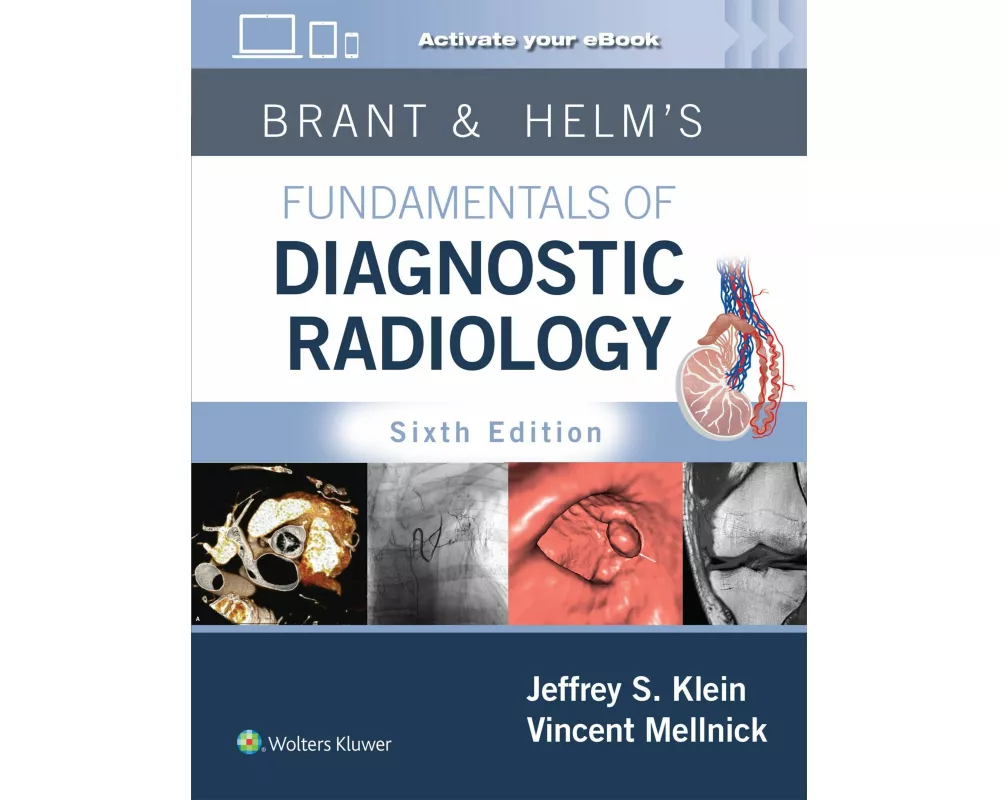 Brant & Helms' Fundamentals of Diagnostic Radiology: Print + eBook with Multimedia