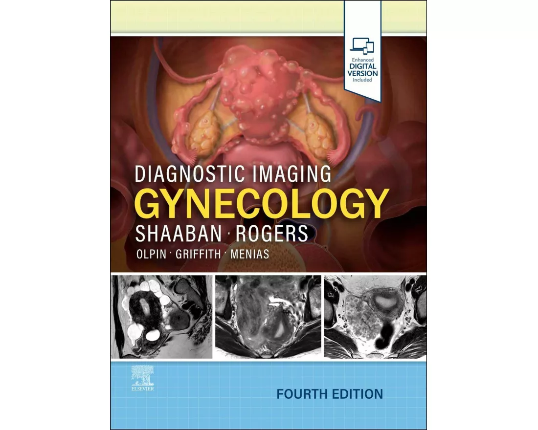 Diagnostic Imaging: Gynecology
