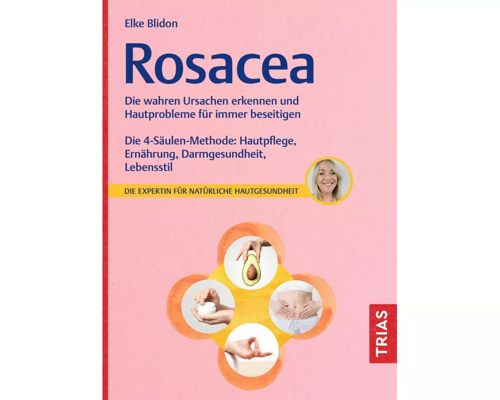 Rosacea