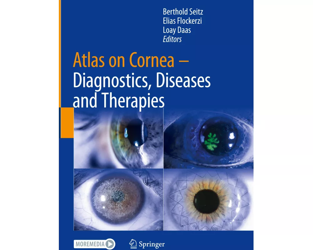 Atlas on Cornea