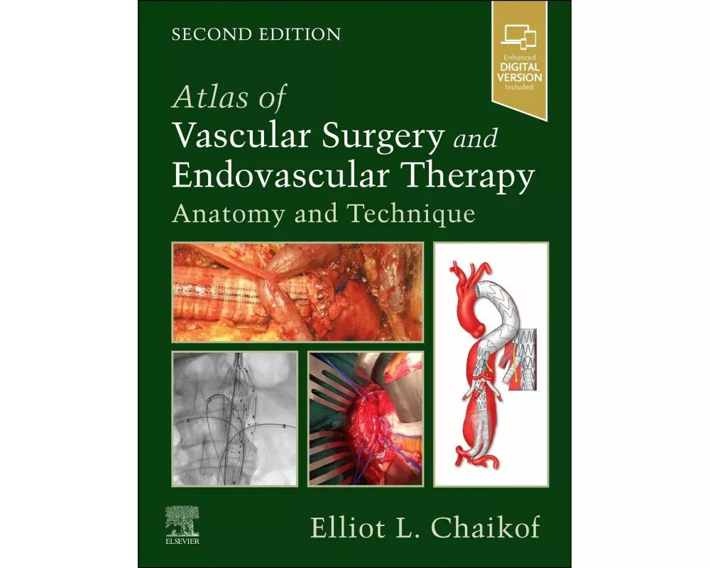Atlas of Vascular Surgery and Endovascular Therapy