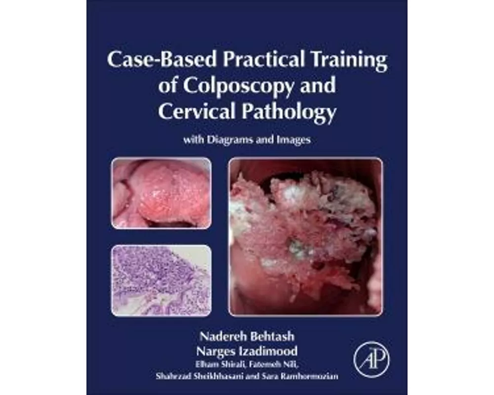 Case-Based Practical Training of Colposcopy and Cervical Pathology