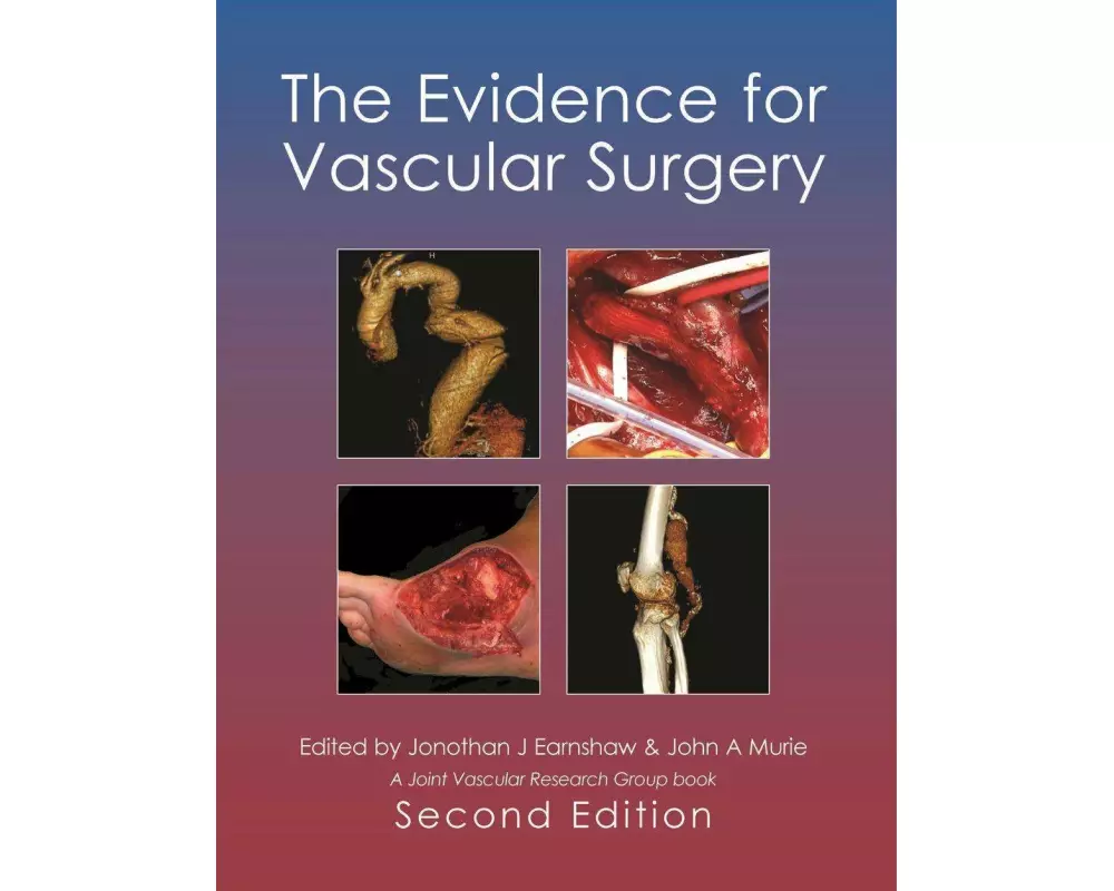 Evidence for Vascular Surgery