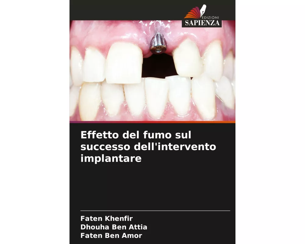 Effetto del fumo sul successo dell'intervento implantare