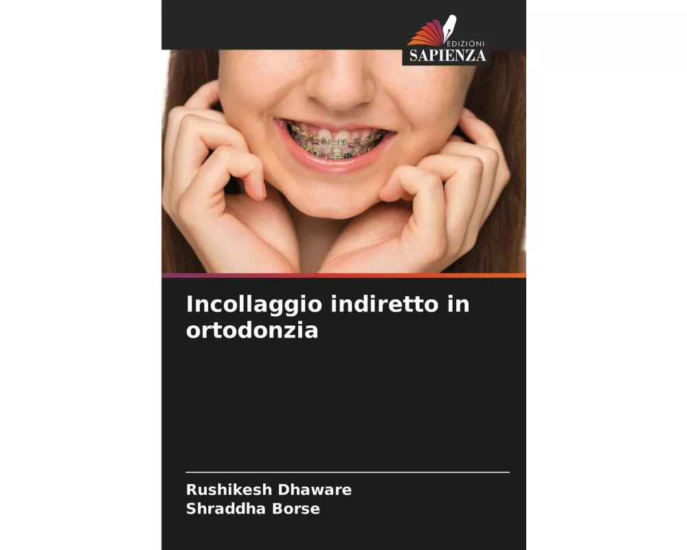 Incollaggio indiretto in ortodonzia