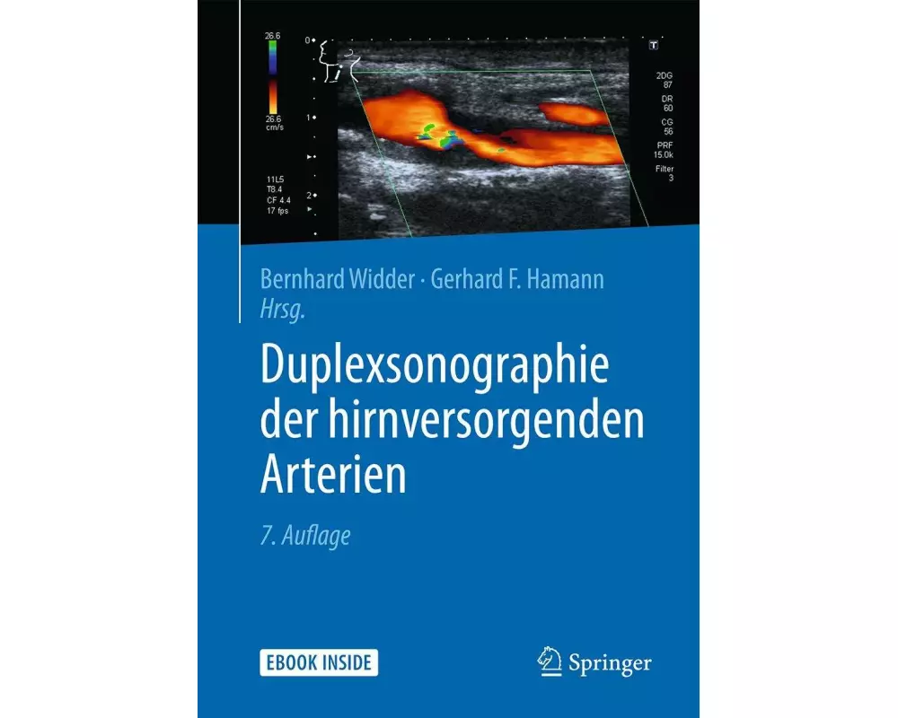 Duplexsonographie der hirnversorgenden Arterien
