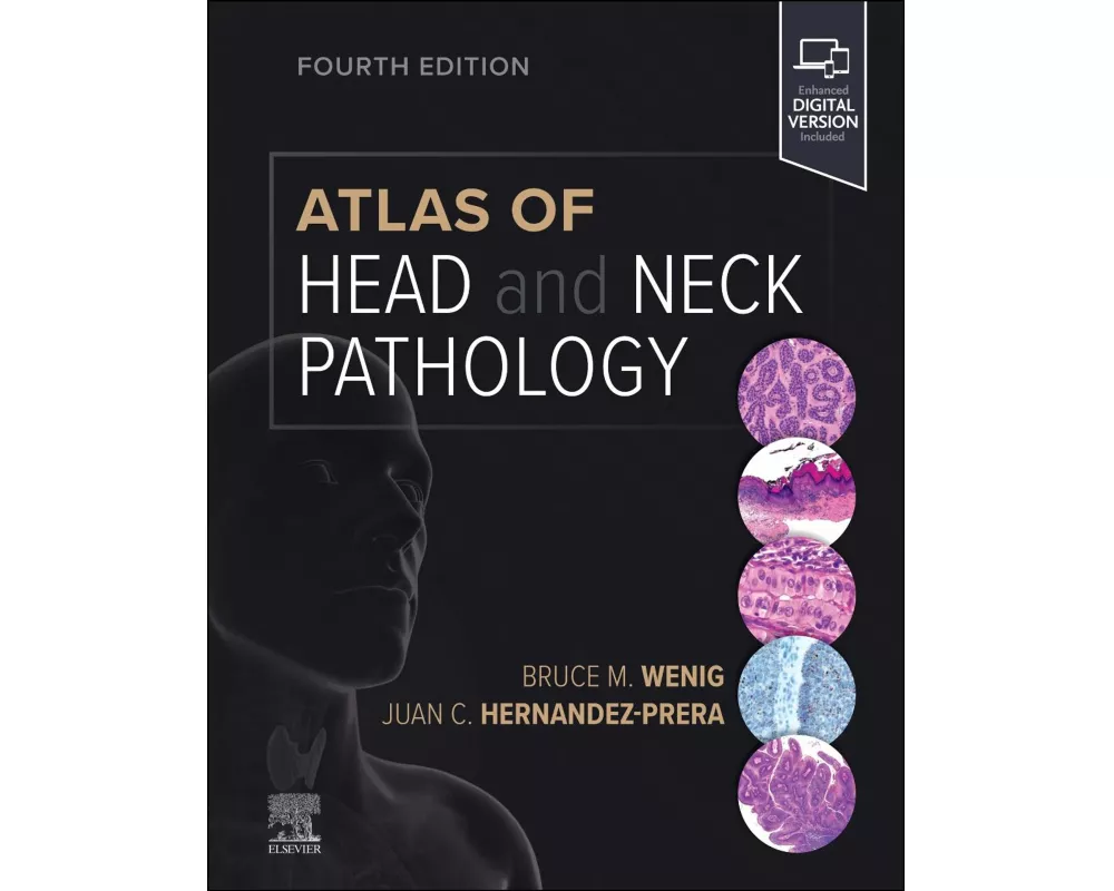 Atlas of Head and Neck Pathology