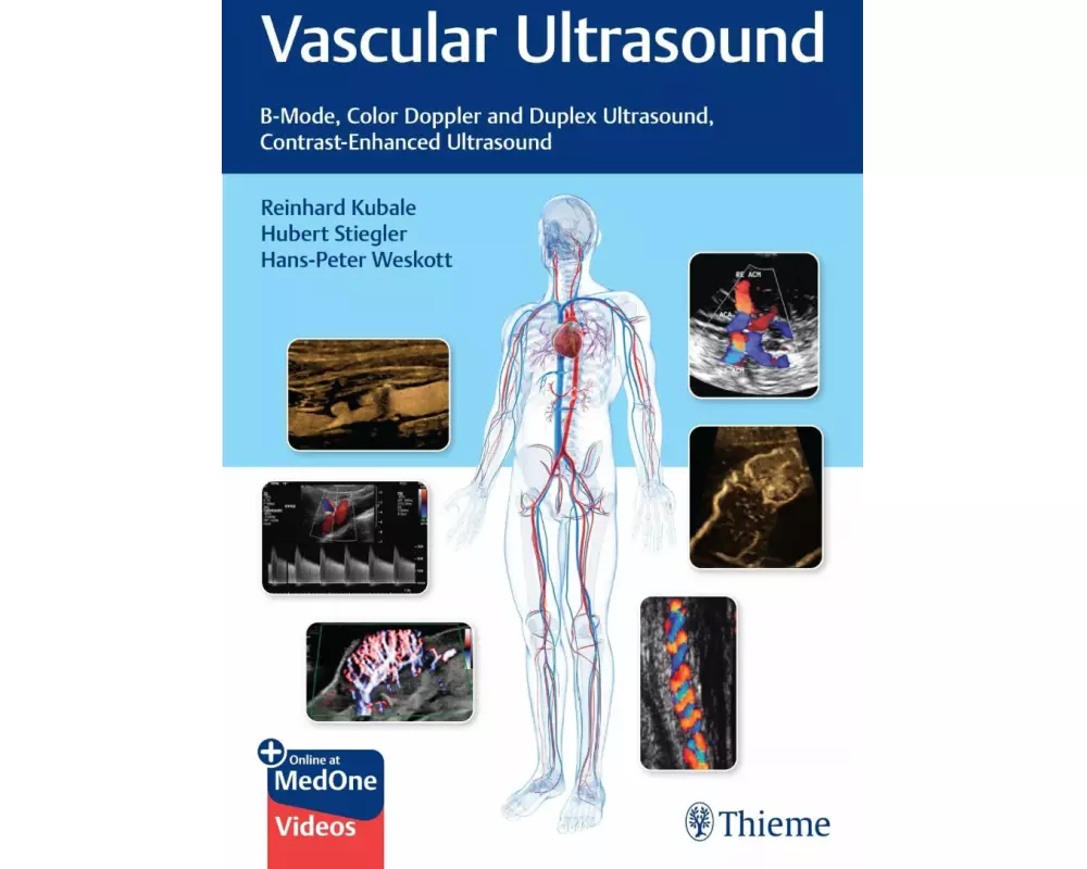 Vascular Ultrasound