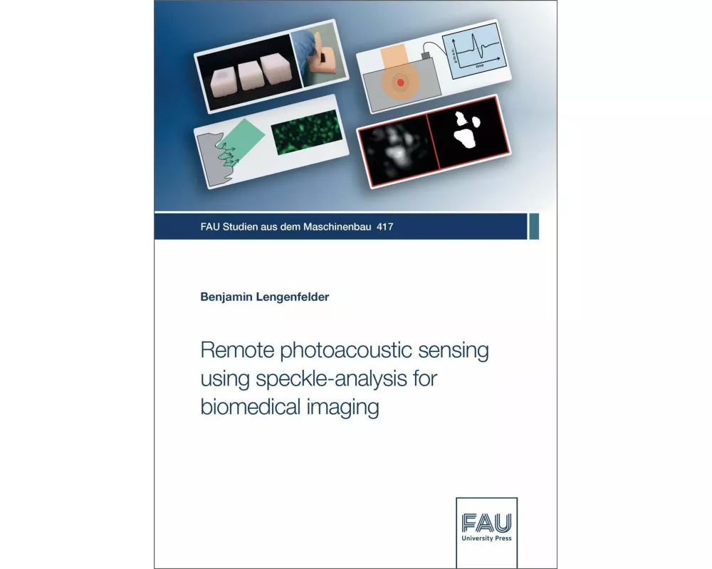 Remote photoacoustic sensing using speckle-analysis for biomedical imaging