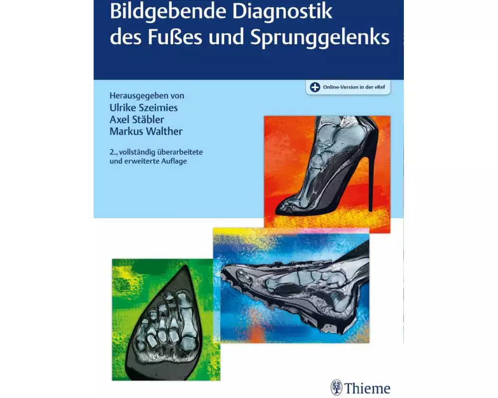 Bildgebende Diagnostik des Fußes und Sprunggelenks