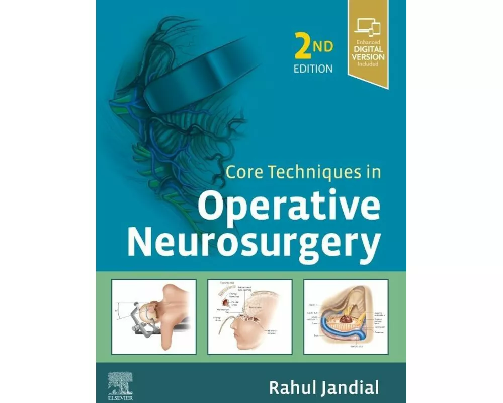 Core Techniques in Operative Neurosurgery