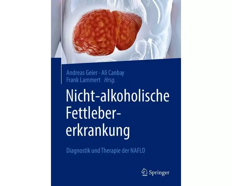 Nicht-alkoholische Fettlebererkrankung