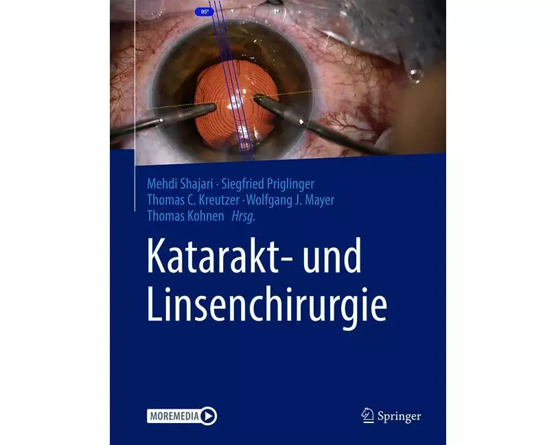 Katarakt- und Linsenchirurgie