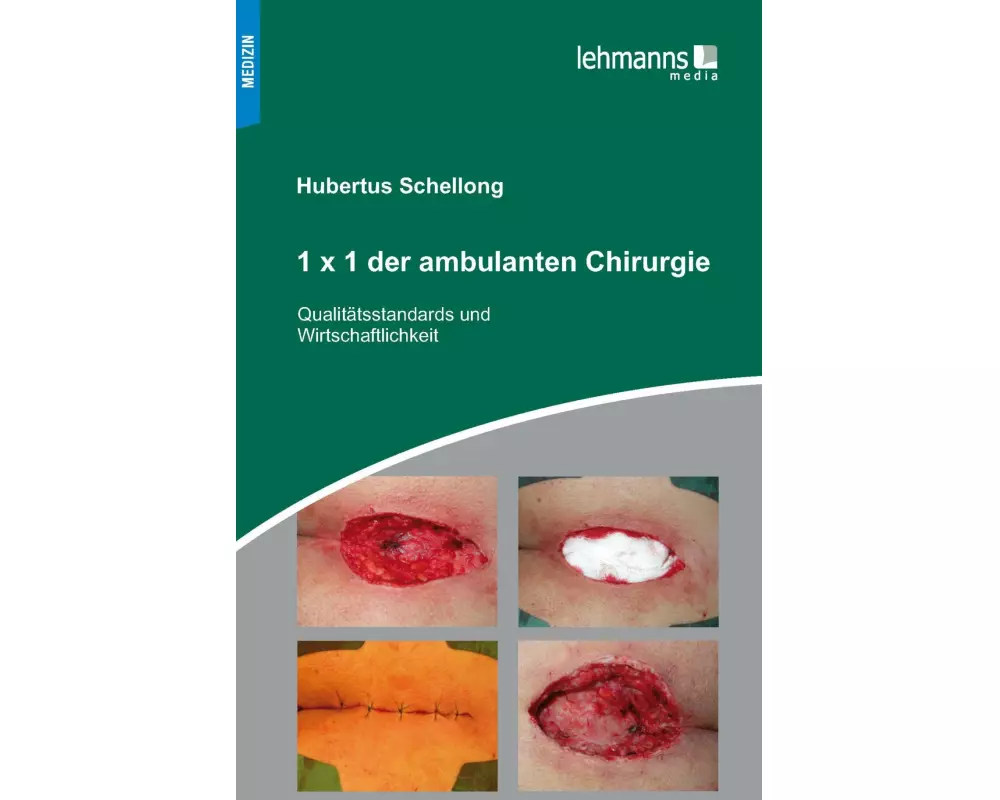 1x1 der ambulanten Chirurgie
