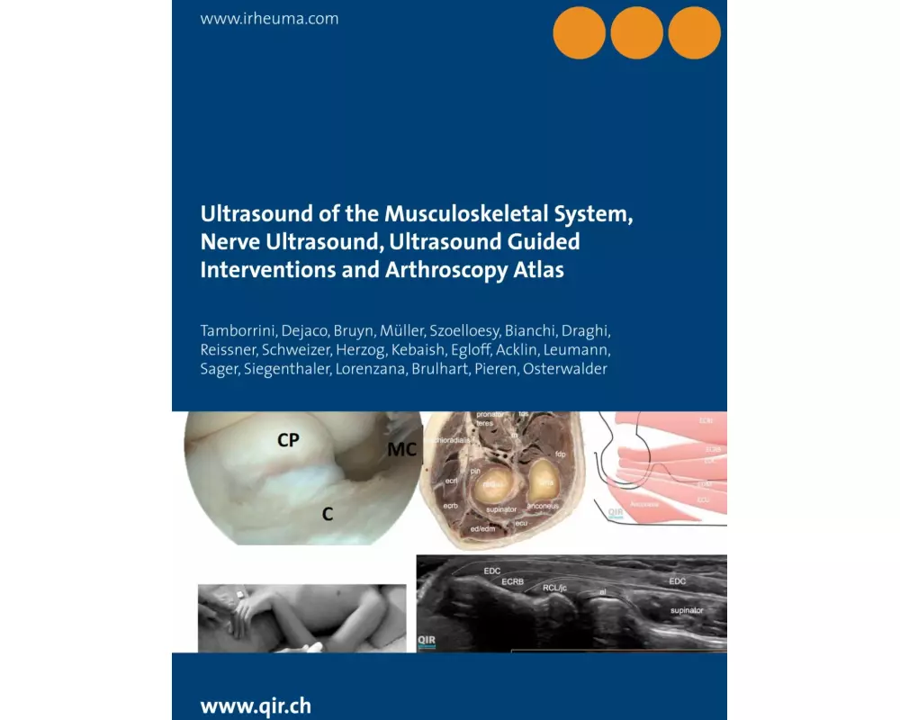 Ultrasound of the Musculoskeletal System, Nerve Ultrasound, Ultrasound Guided Interventions and Arthroscopy Atlas