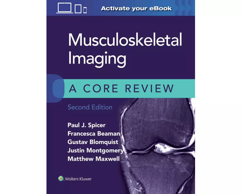Musculoskeletal Imaging: A Core Review