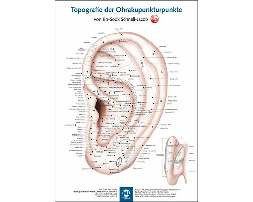 Poster - Topografie der Ohrakupunkturpunkte