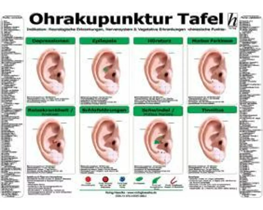 Ohrakupunktur Tafel - Indikation: Neurologische Erkrankungen, Nervensystem & Vegetative Erkrankungen