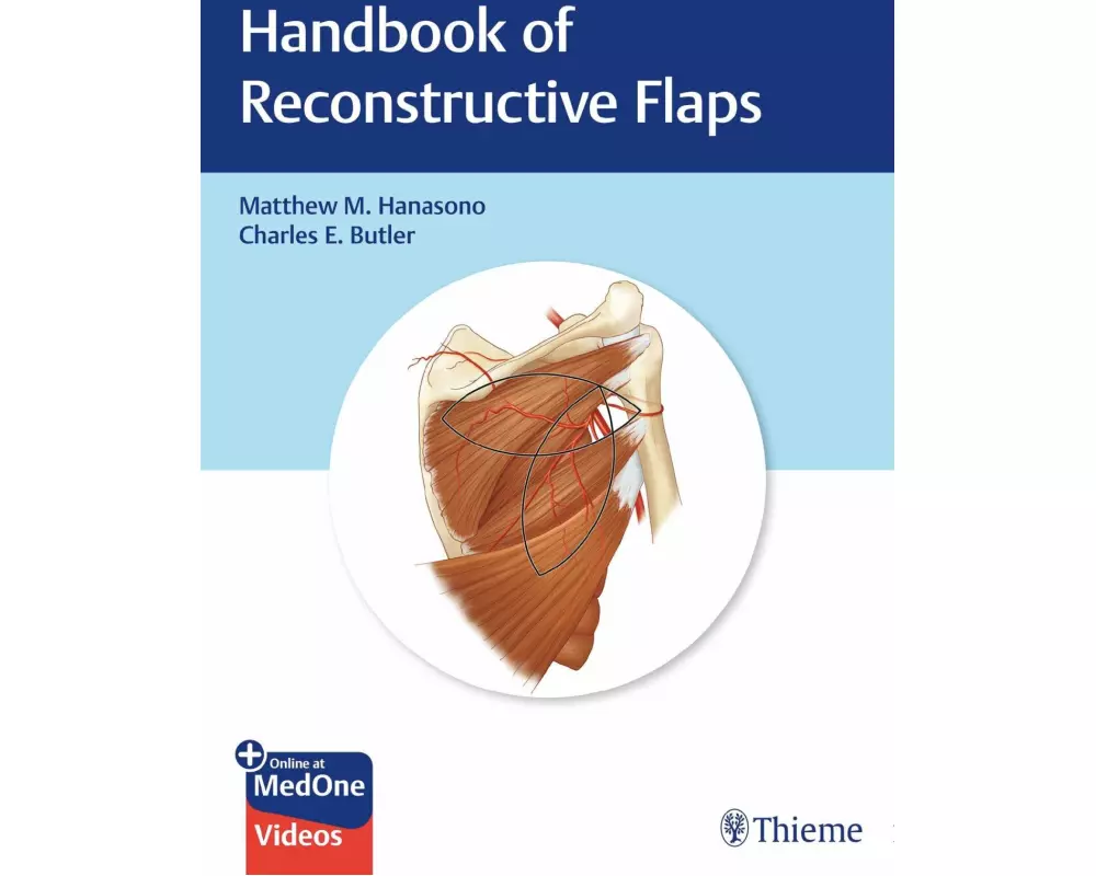 Handbook of Reconstructive Flaps