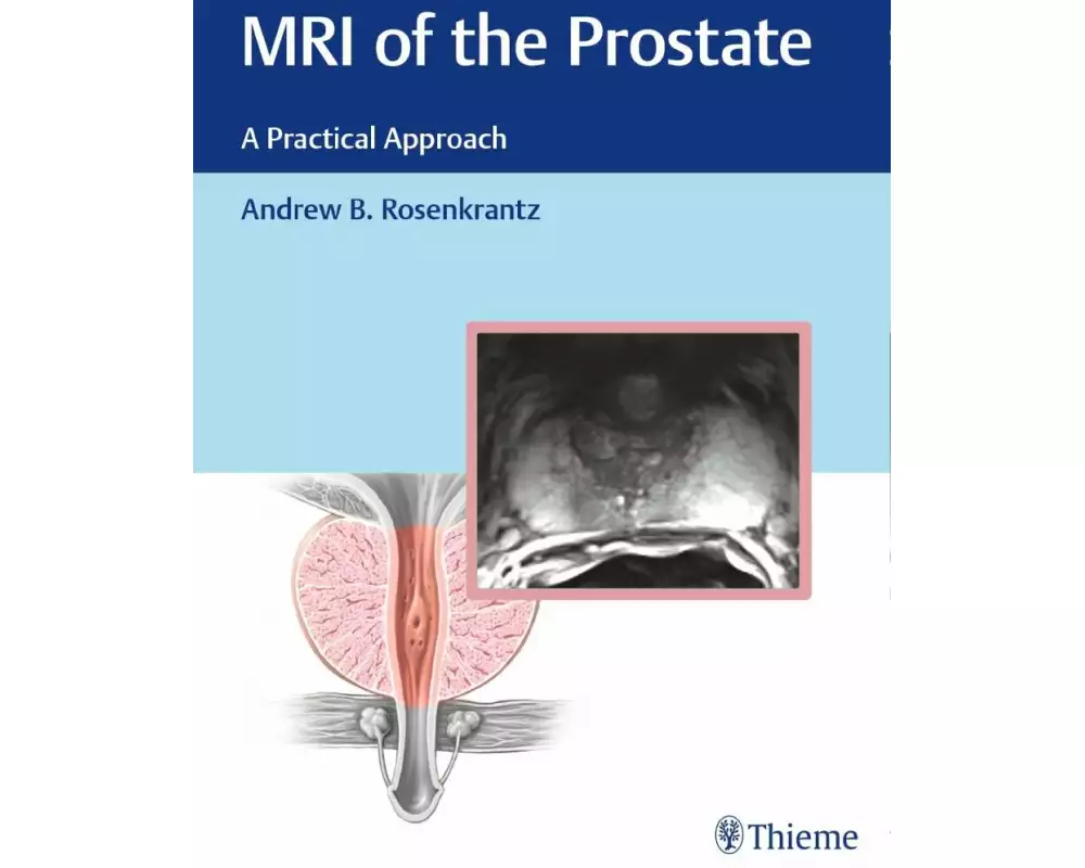 MRI of the Prostate