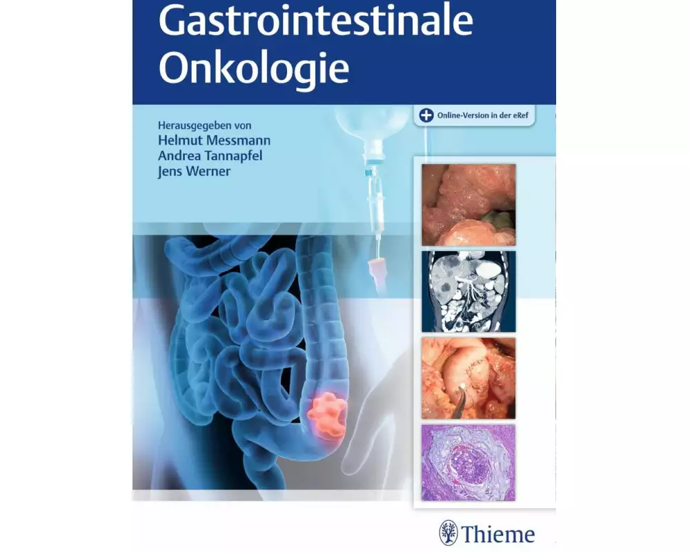 Gastrointestinale Onkologie
