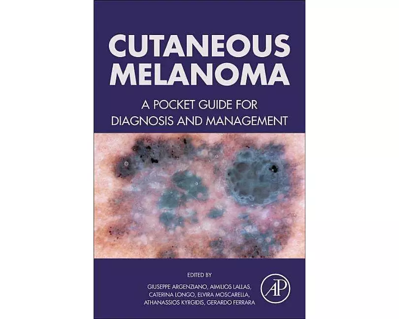 Cutaneous Melanoma