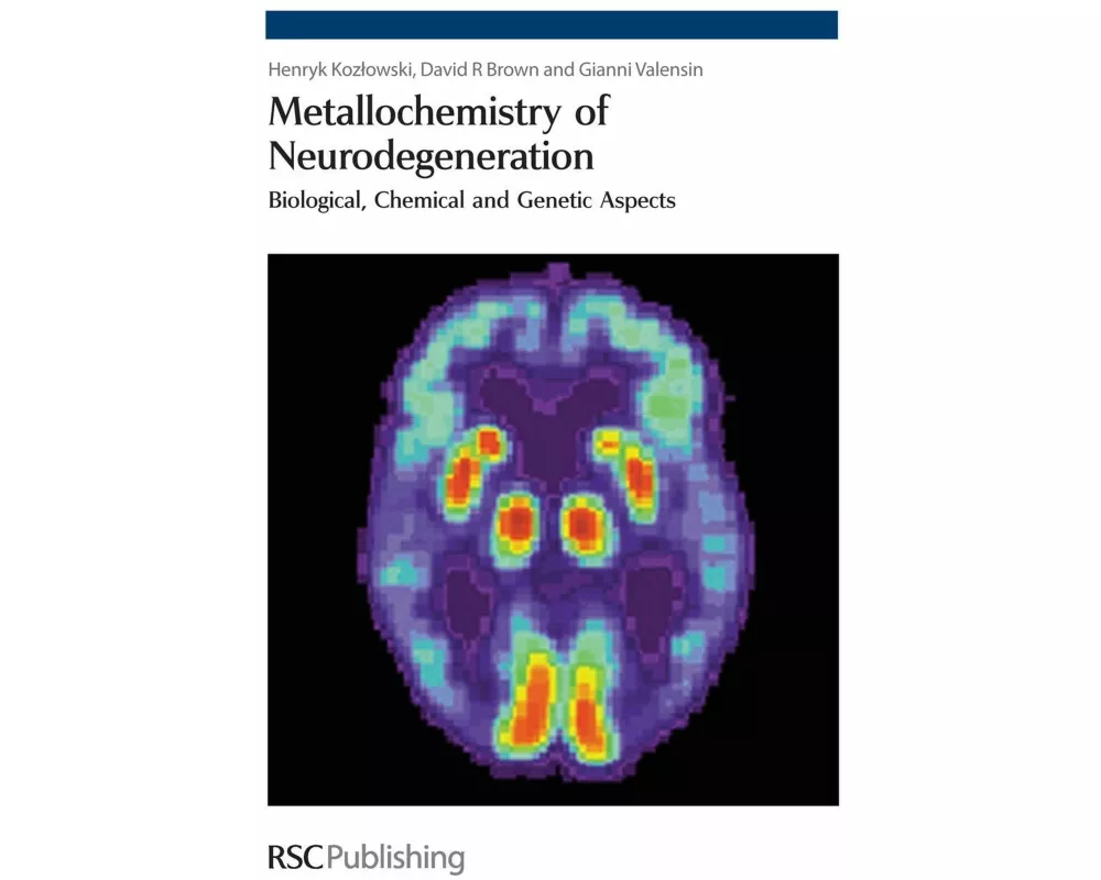 Metallochemistry of Neurodegeneration