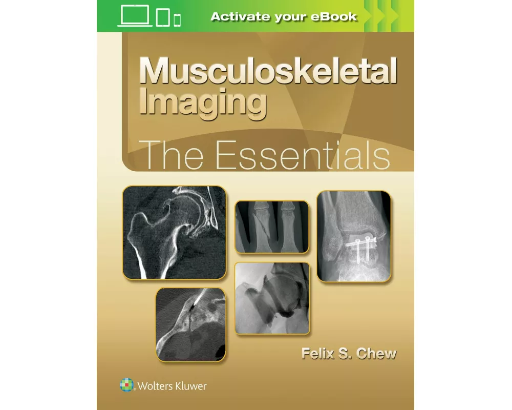 Musculoskeletal Imaging: The Essentials