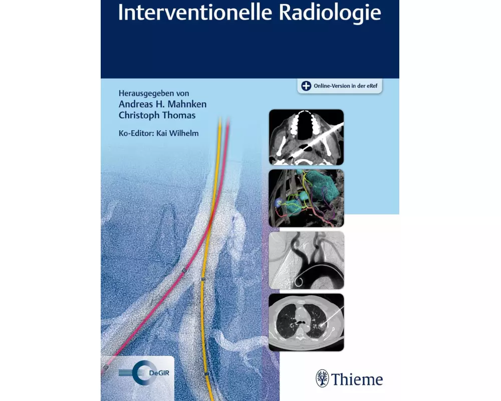 Interventionelle Radiologie