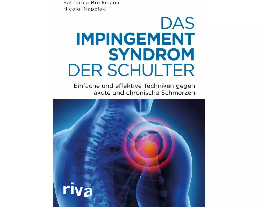 Das Impingement-Syndrom der Schulter