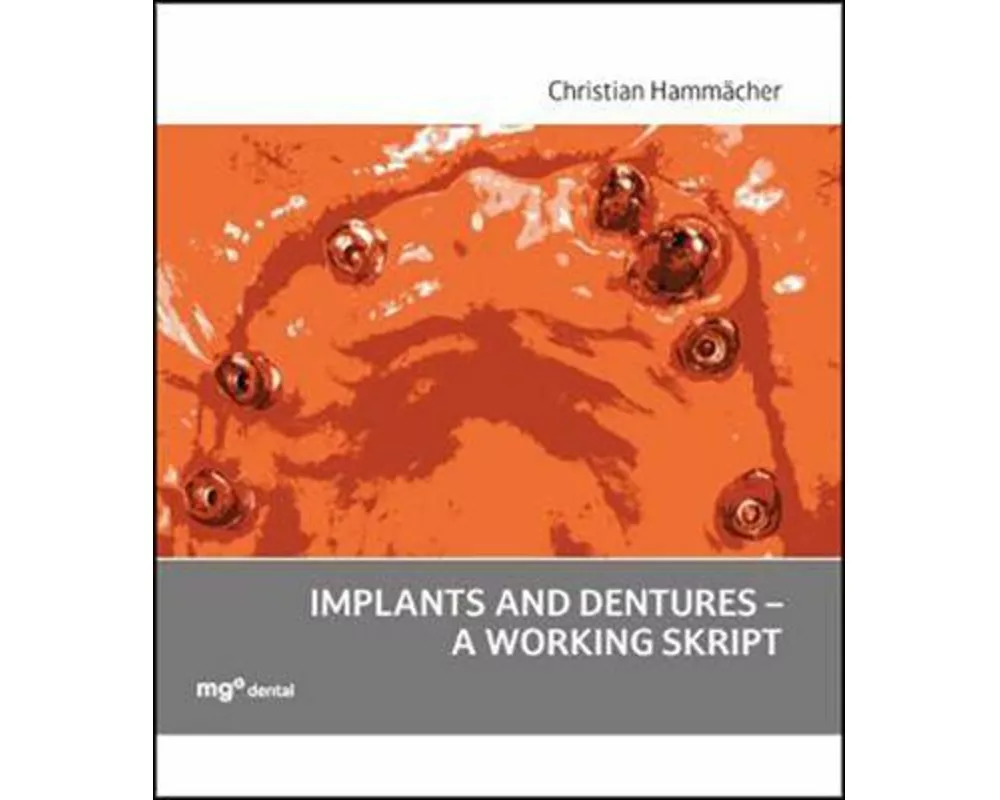 Implants and dentures - a working skript